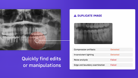 240516-health-dental-xray-scan (1)